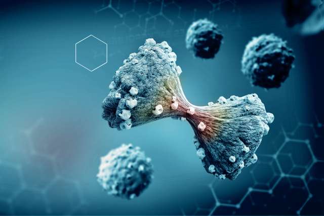 Prostate cancer cells
