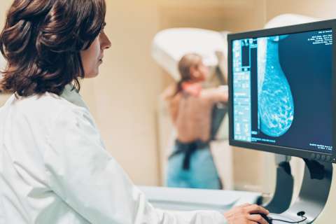 Mammography